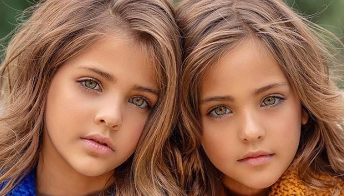 These Twins Were Named “Most Beautiful in The World,” Wait Till You See Them Today