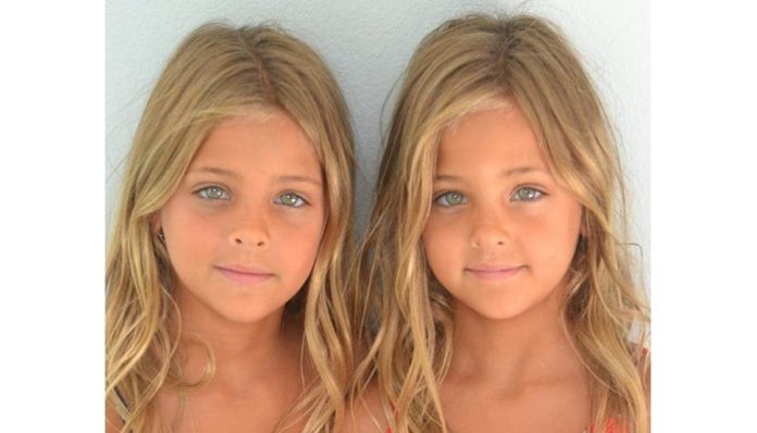 These Twins Were Named “most Beautiful In The World ” Wait Till You See Them Today