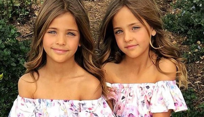 These Twins Were Named “Most Beautiful in The World,” Wait Till You See ...