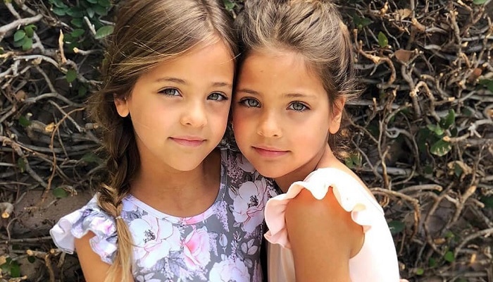 These Twins Were Named “Most Beautiful in The World,” Wait Till You See ...