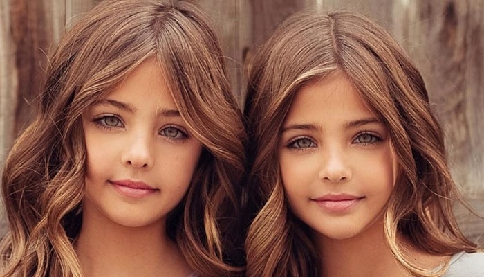 These Twins Were Named “most Beautiful In The World” Wait Till You See